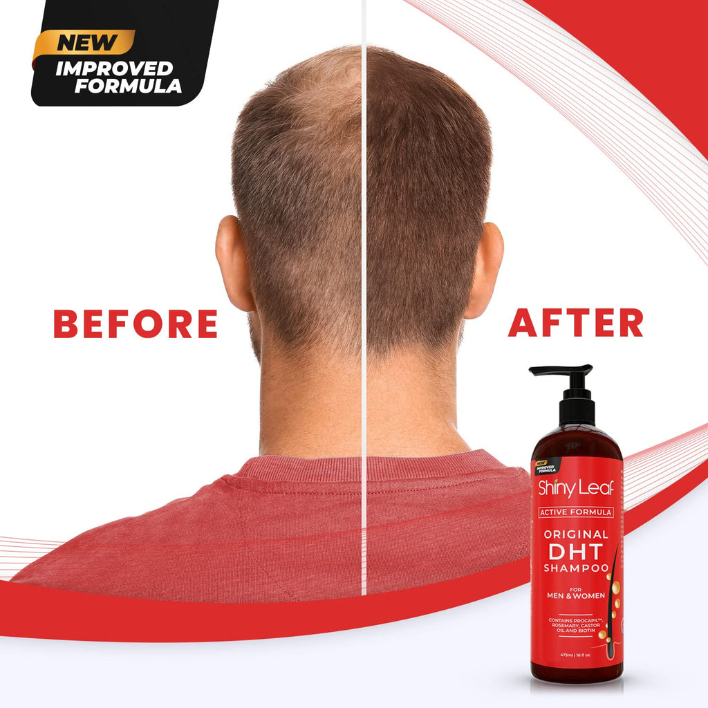 Thicker, Fuller Hair in Every Wash | DHT Blocker Set with Biotin & Rosemary (2 x 16 oz)