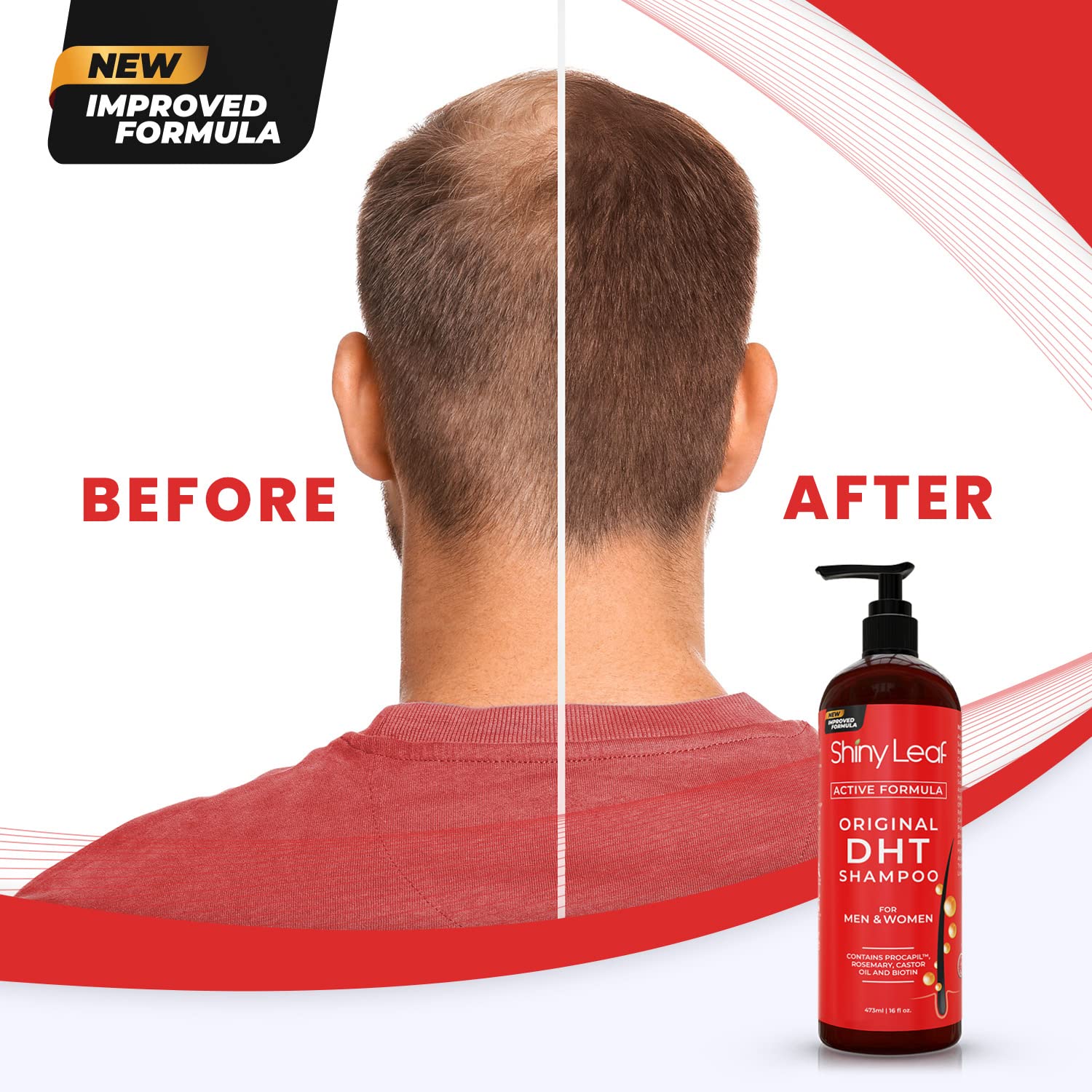 Thicker, Fuller Hair in Every Wash | DHT Blocker Set with Biotin & Rosemary (2 x 16 oz)